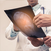 单次伽玛刀放射手术治疗视神经通路/下丘脑神经胶质瘤