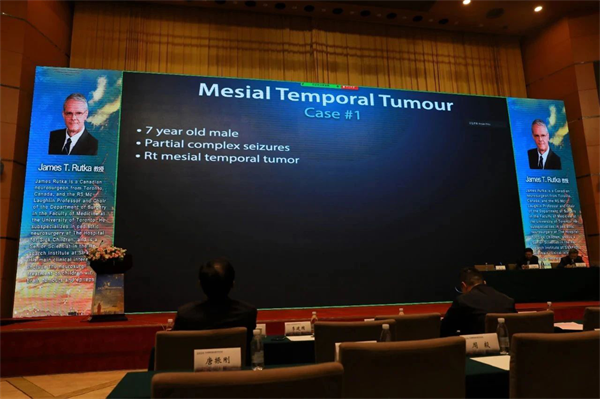 小儿神经外科医师