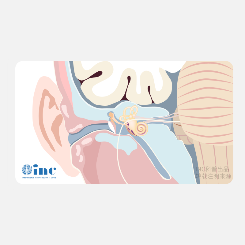 听神经瘤的解剖