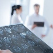 靶向MET用于神经胶质瘤治疗