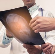 脑胶质瘤手术的临床体会——克服传统神经导航引导手术的局限性