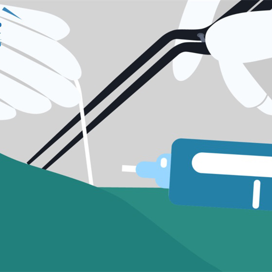 颅咽管瘤能完全根治吗？手术后过度肥胖怎么办？