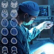 儿童后颅窝低级别星形细胞瘤的临床特征、长期并发症和健康相关生活质量