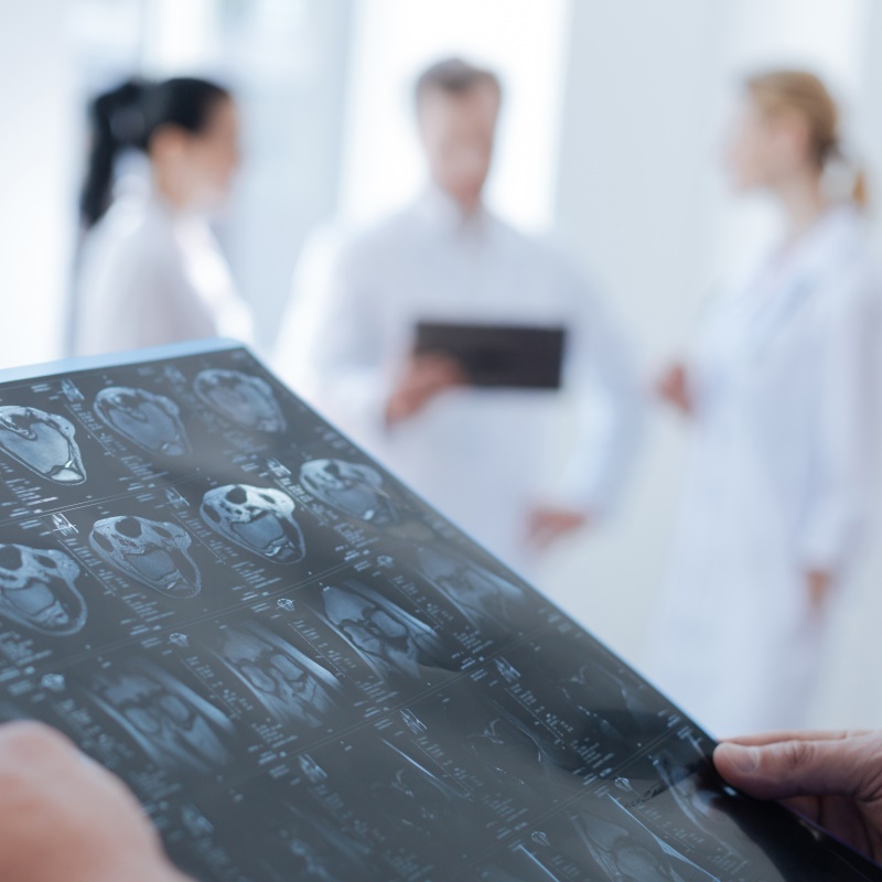 肿瘤内异质性：胶质母细胞瘤治疗耐药性和复发的途径