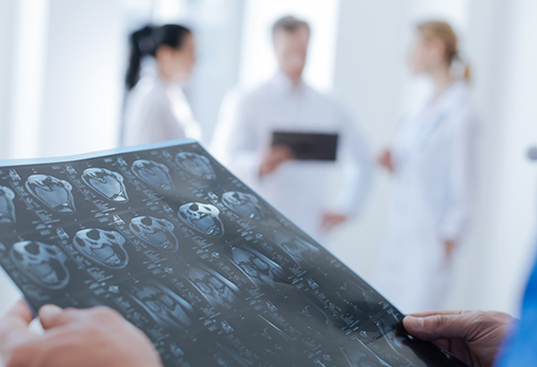 儿童颞叶癫痫手术