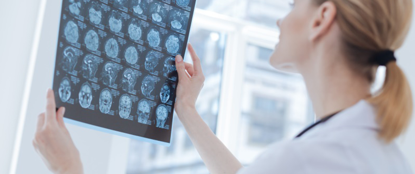 胶质瘤如何诊断