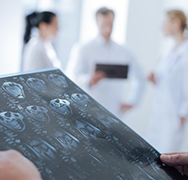 中国神经外科术后如何加速康复外科？