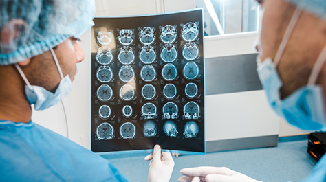 颅内脑膜瘤患者手术和放疗后的生存问题