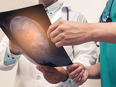 儿童小脑星形细胞瘤的临床表现和手术治疗结果