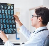 EANO关于成人弥漫性神经胶质瘤的诊断和治疗指南