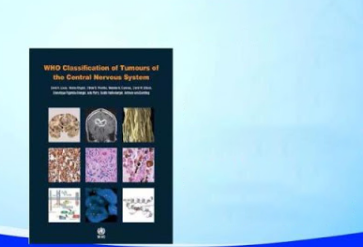 脑胶质瘤病理诊断的问题和发展