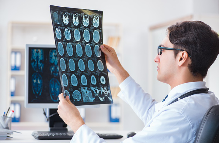 怀孕期间发生脑血管瘤怎么办？