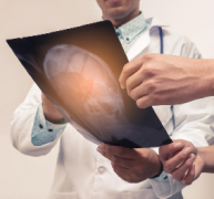 什么是胶质母细胞瘤？胶质母细胞瘤存活率介绍