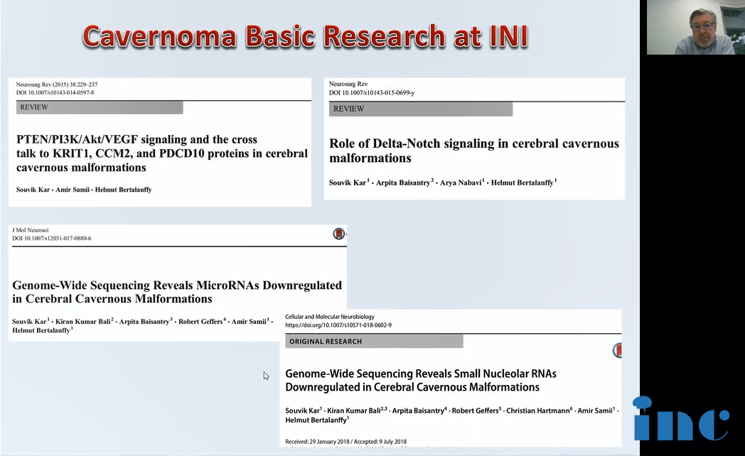 桥脑海绵状血管瘤