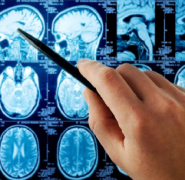 垂体瘤什么时候需要做手术？