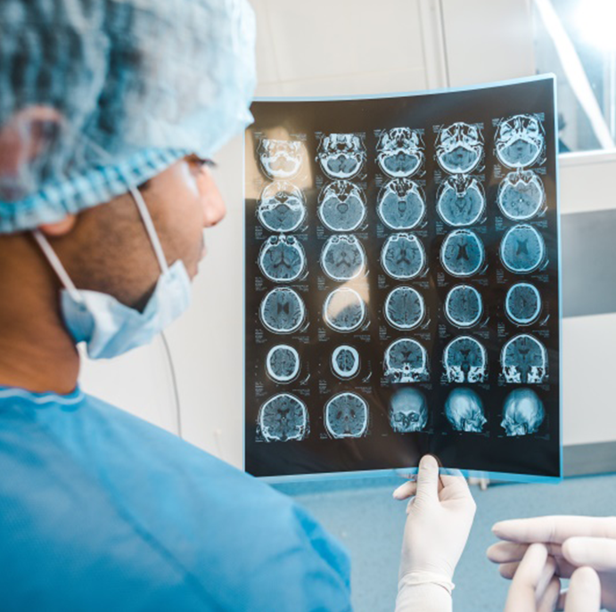 丘脑星形细胞瘤和下丘脑星形细胞瘤有哪些治疗选择？