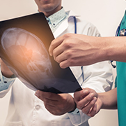 问：脑桥胶质瘤症状表现有哪些？