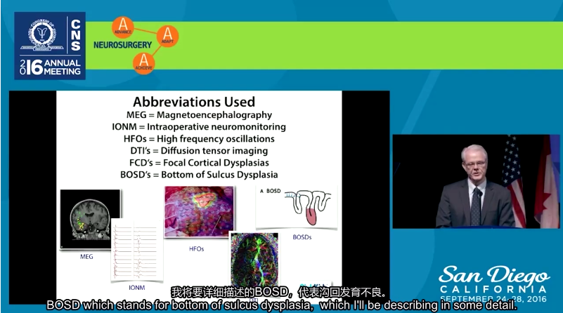癫痫能治好吗？INC加拿大Rutka教授解读癫痫手术进展和临床成功案例