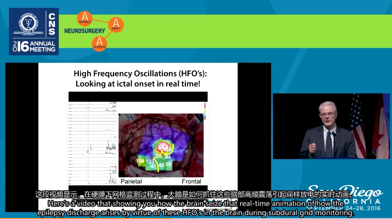 癫痫能治好吗？