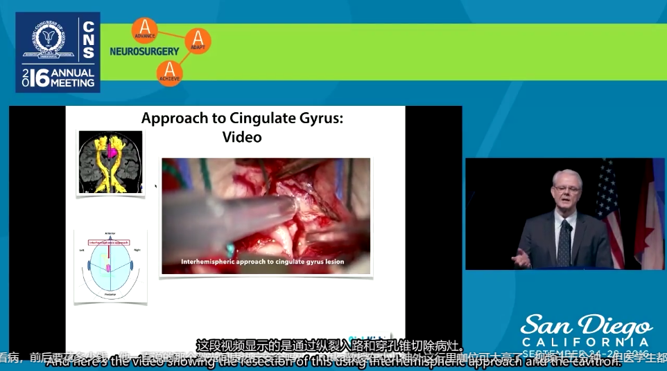 癫痫能治好吗？