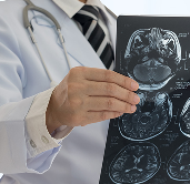 「脑膜瘤严重吗」老年人脑膜瘤严重吗？