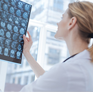 听神经瘤面瘫等级？为什么手术全切了还是面瘫？