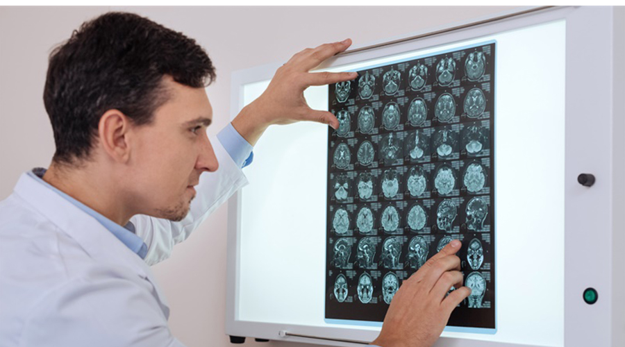 听神经瘤怎么检查？如何确诊？