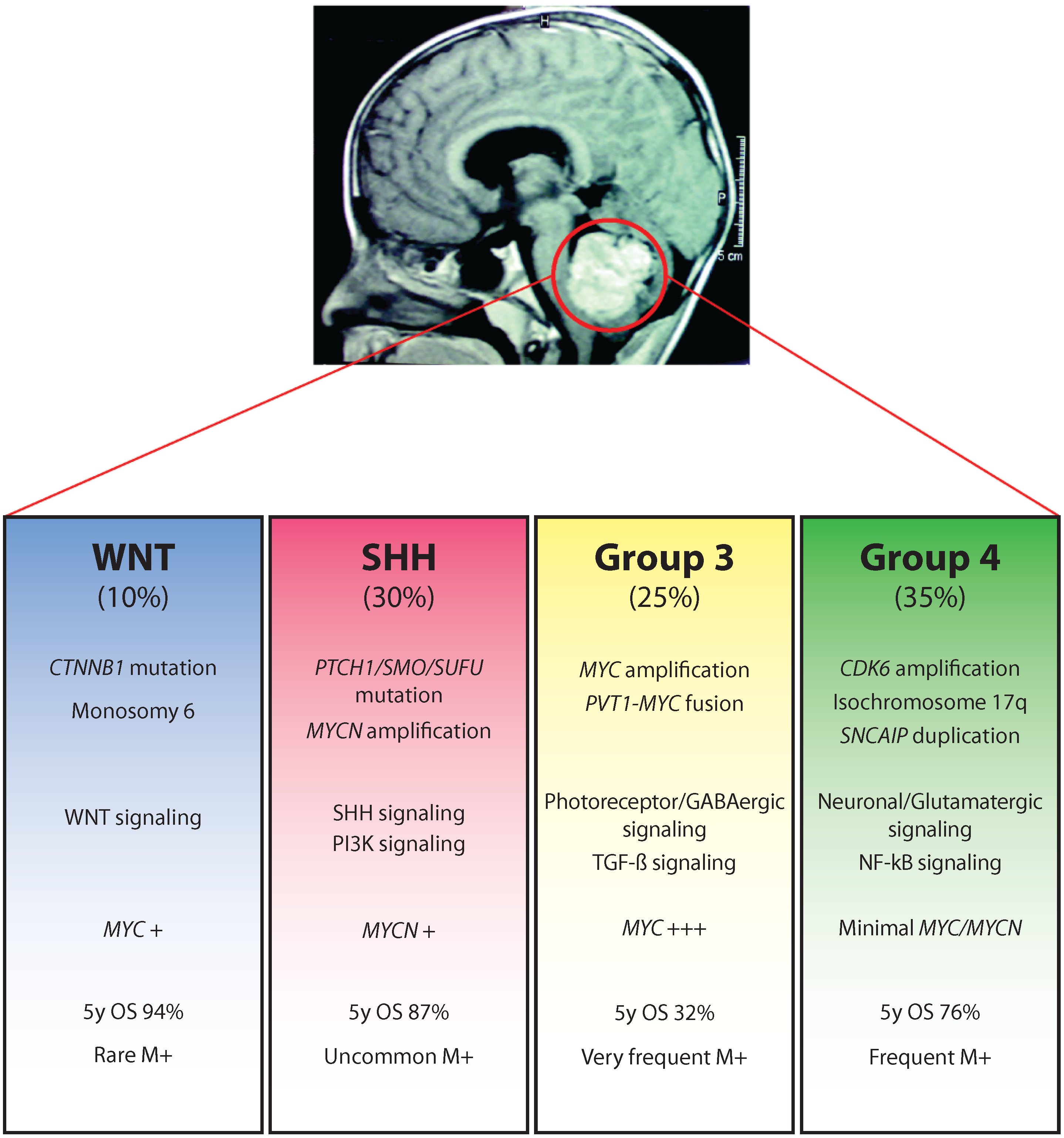 髓母细胞瘤有良性的吗？有什么治疗选择？