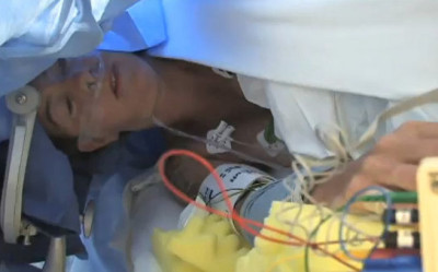 术中唤醒开颅术0