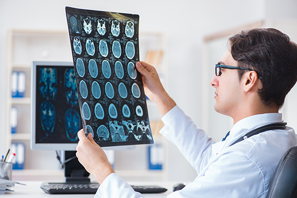 颅内海绵状血管瘤