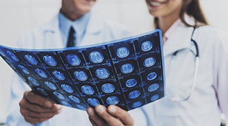 颅内海绵状血管瘤0