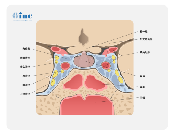 脑垂体瘤是什么病？侵袭性垂体瘤复发的可能性大吗？