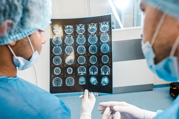 椎管内静脉高压综合征诊断方法