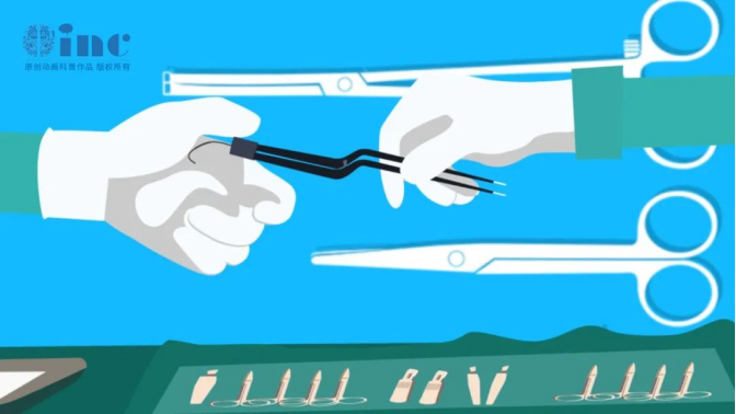 蜘蛛网膜囊肿怎么办