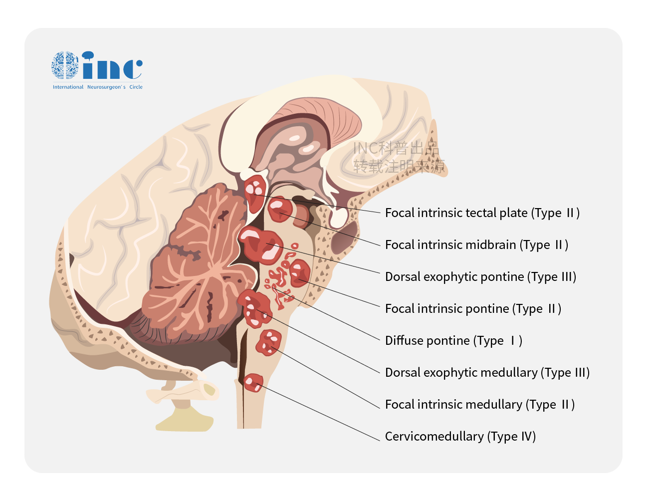 典型脑出血病例分享（含CT及MRI） - 病例中心(诊疗助手) - 爱爱医医学网