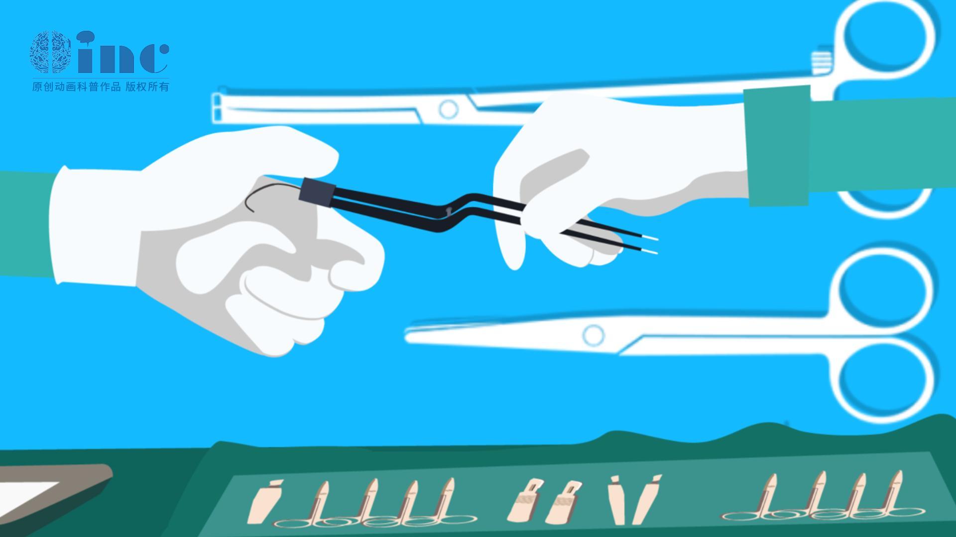 胶质瘤怎么治疗