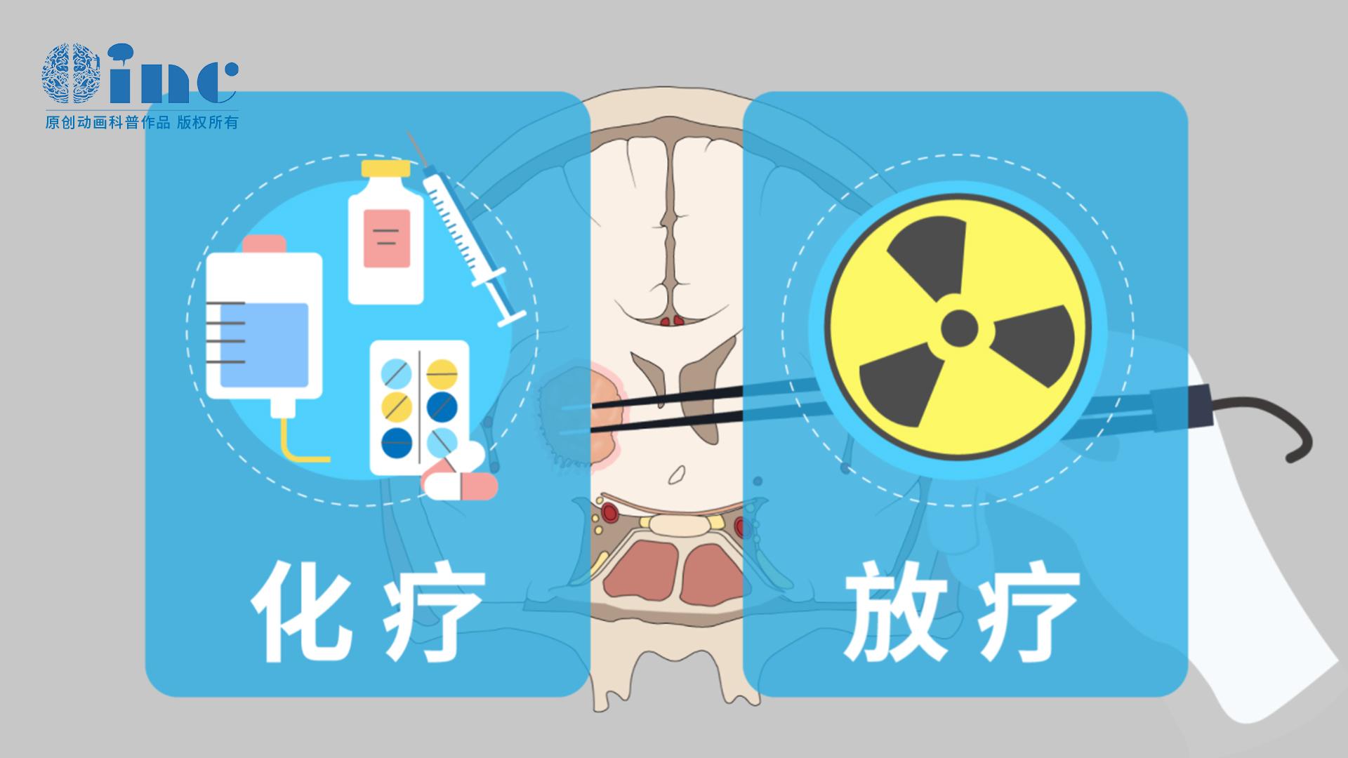 脑胶质瘤能够被术后放疗治愈吗?脑胶质瘤放疗的作用是什么?