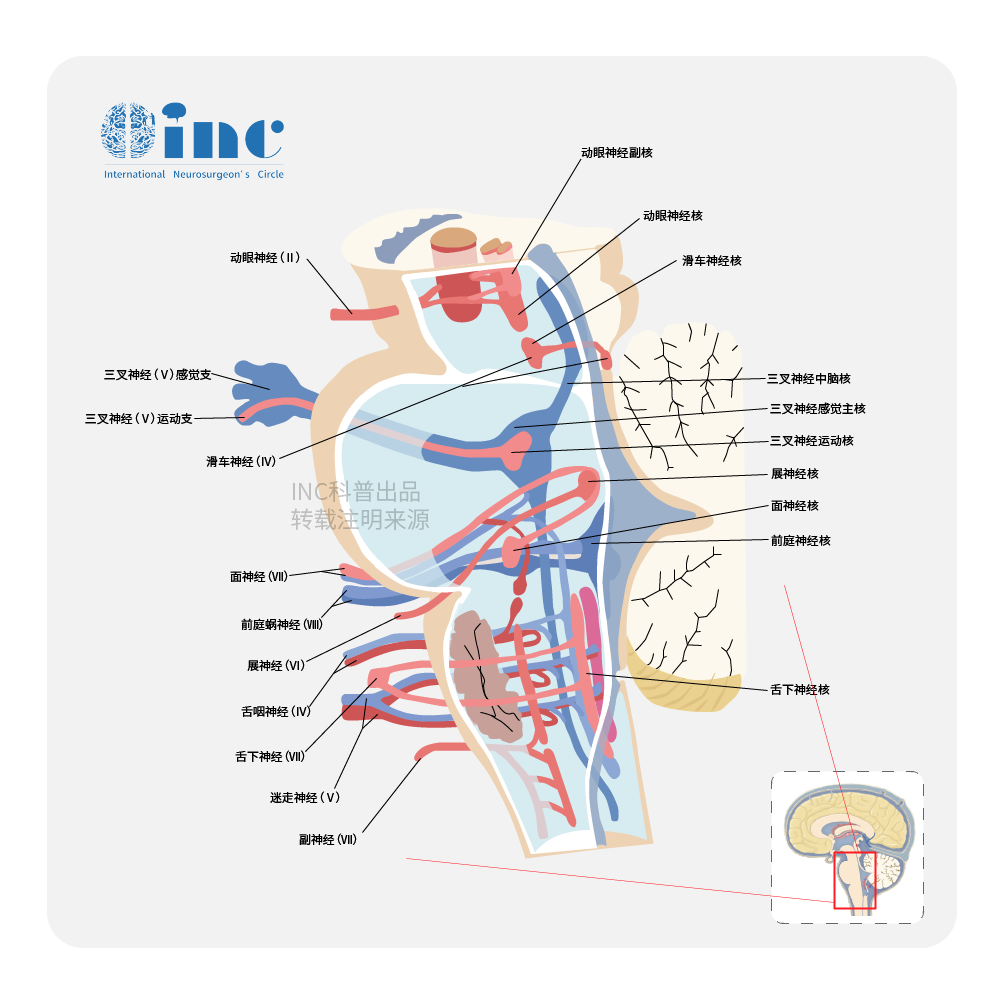 脑干海绵状血管瘤有哪些症状?