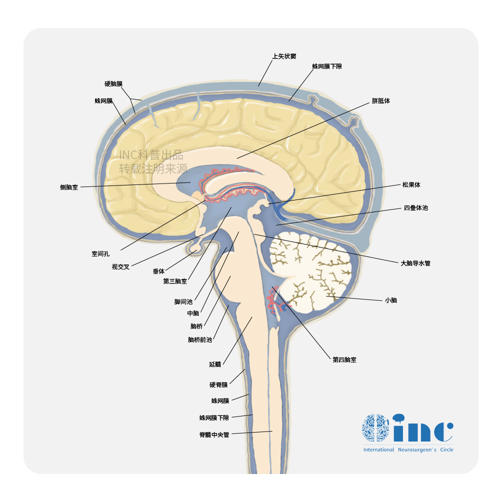 三脑室肿瘤好治吗？脑室内颅咽管瘤手术挑战