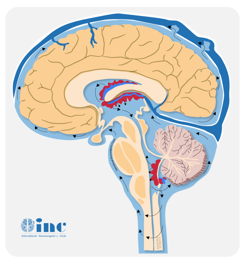 胶质瘤是良性还是恶性？