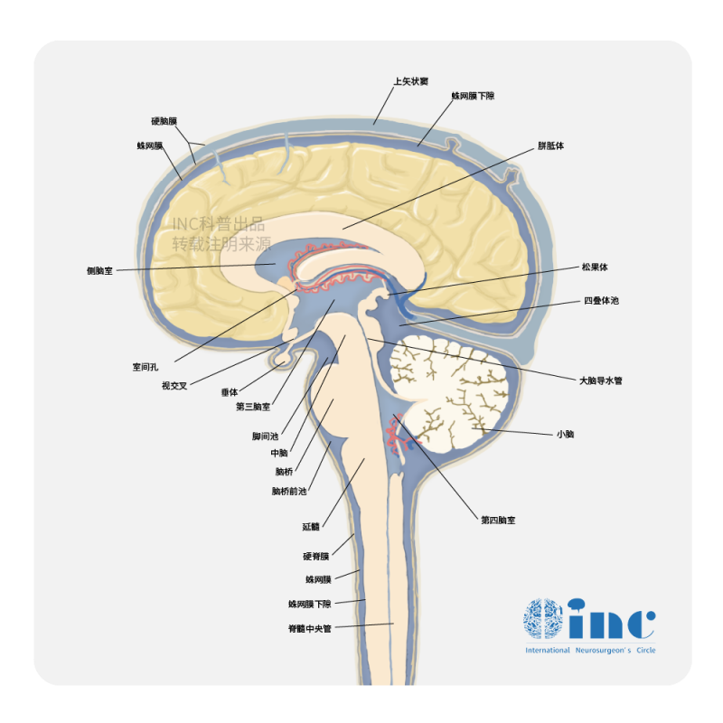 脑干海绵状血管瘤怎么治疗比较好?INC德国巴特朗菲教授成功手术经验总结