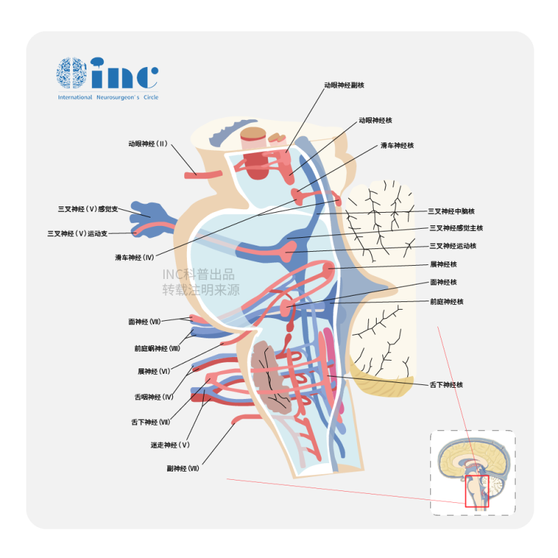 脑干肿瘤手术成功率有多大