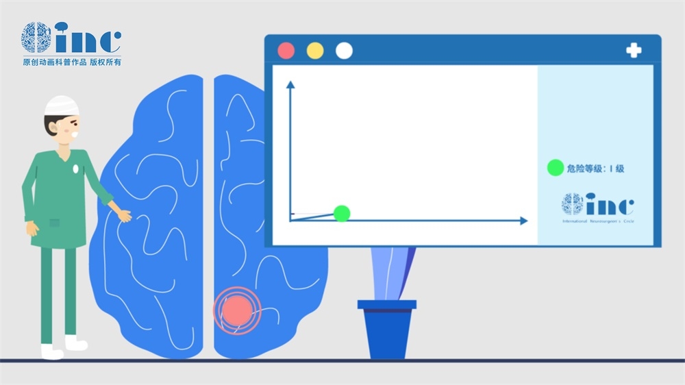 海绵窦区脑膜瘤