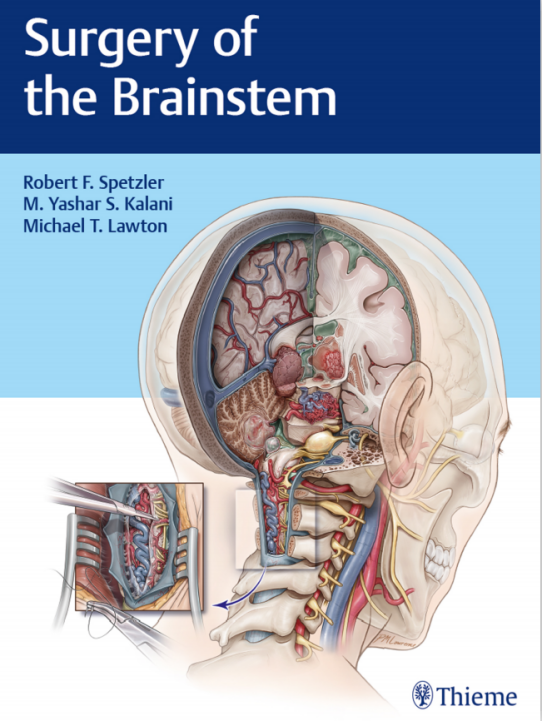 世界脑干手术专著《Surgery of the Brainstem》图片