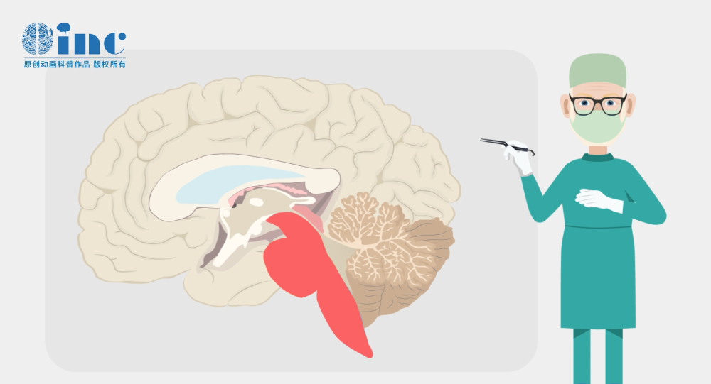 脑干胶质瘤放疗的危害？放疗有危险吗？