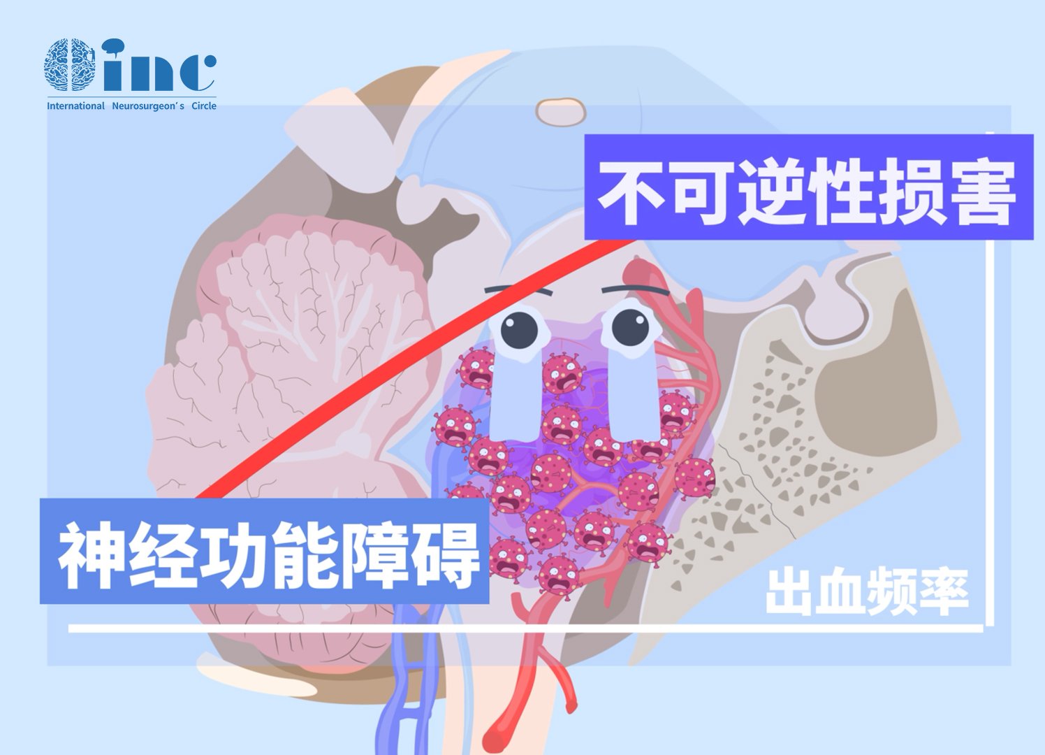 脑干海绵状血管瘤和脑干出血的区别是什么？