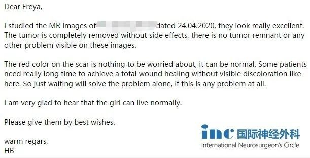 功能区胶质瘤治疗1