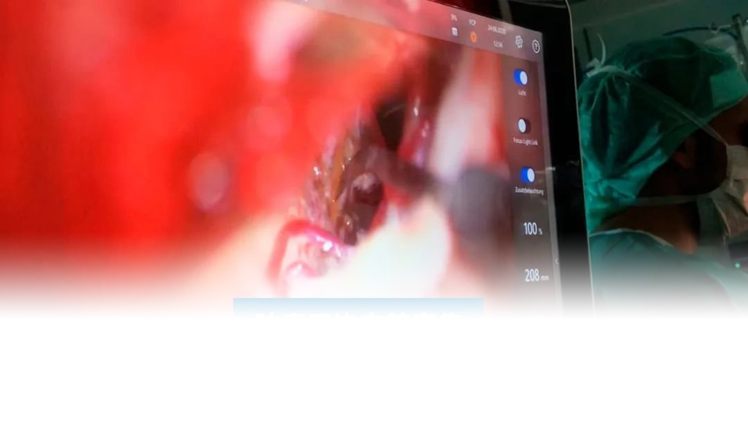 颈髓海绵状血管瘤手术治疗