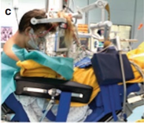 松果体区海绵状血管瘤