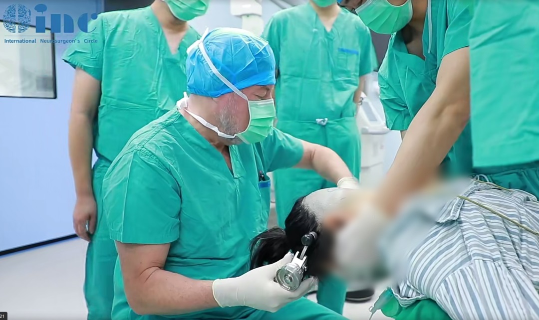 脑干海绵状血管瘤手术